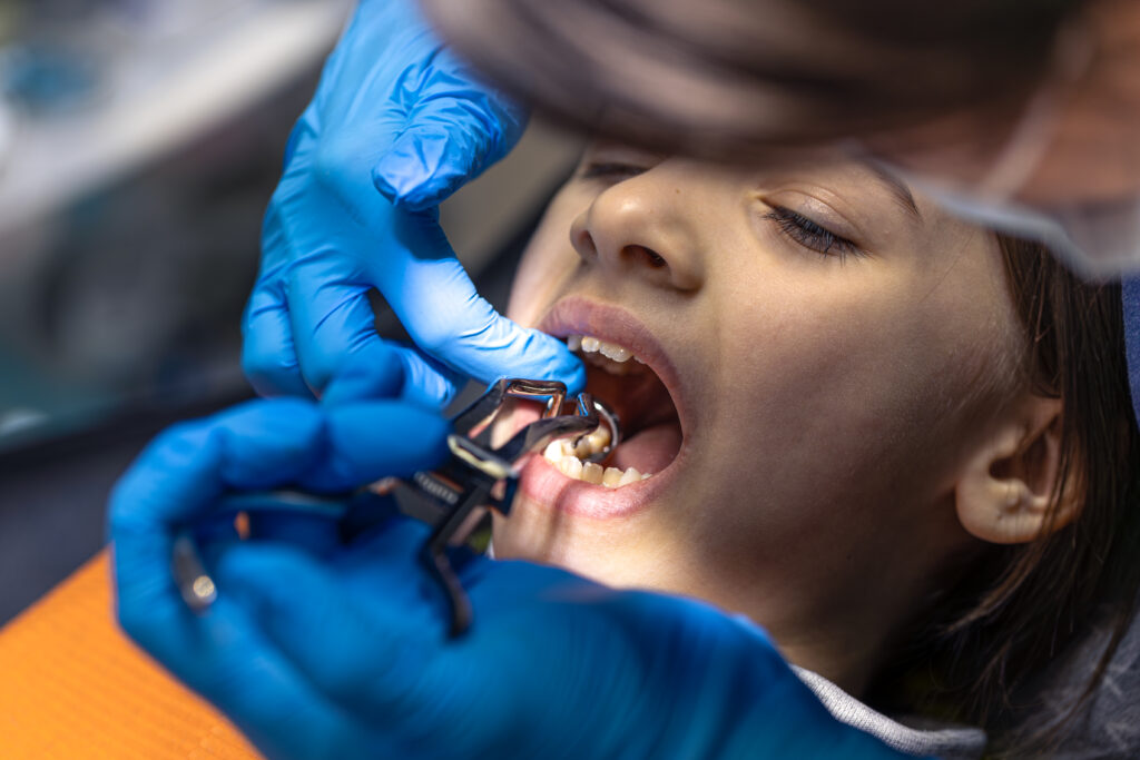 Absceso dental o «postemilla»: Los peligros de intentar drenarlo en casa