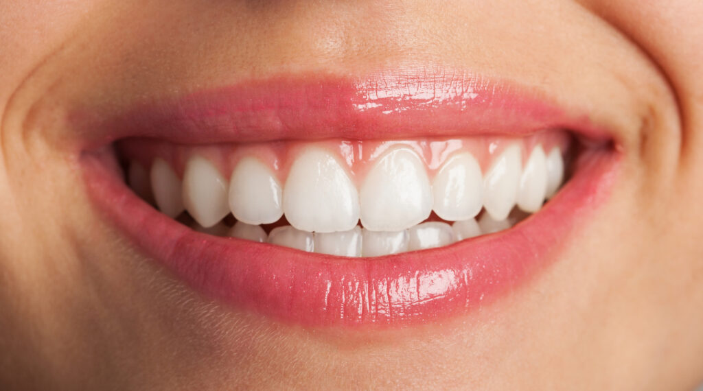 Filtraciones, roturas y encías negras: Las 3 señales de que tus carillas dentales necesitan urgencia médica